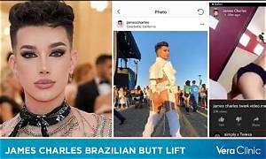 James Charles Bbl Rumors Explained: the Truth Behind His Viral Looks